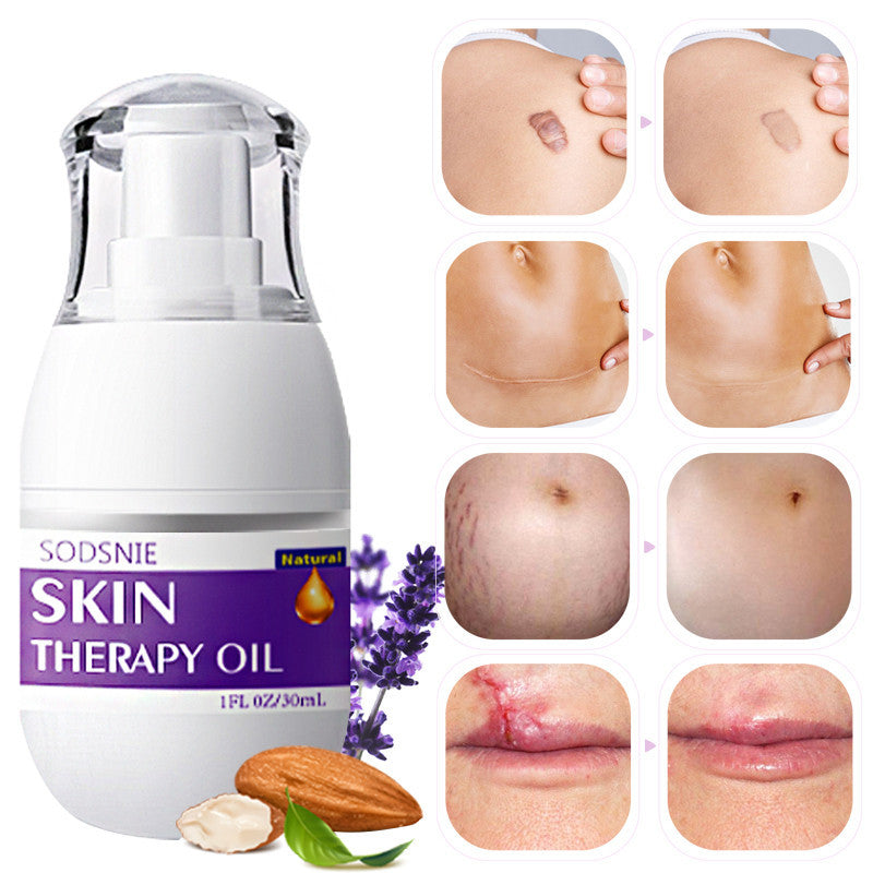 - Skin Repair & Stretch Mark Oil – 30ml -  Skin Repair & Stretch Mark Oil – 30ml