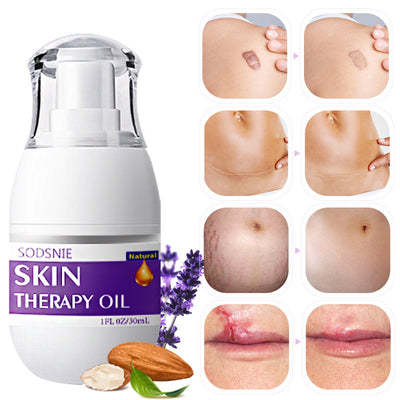 - Skin Repair & Stretch Mark Oil – 30ml -  Skin Repair & Stretch Mark Oil – 30ml