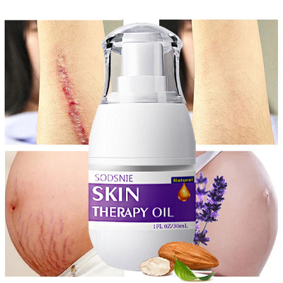 - Skin Repair & Stretch Mark Oil – 30ml - Skin Repair & Stretch Mark Oil – 30ml